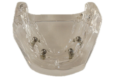 Implant Model - TM-T15