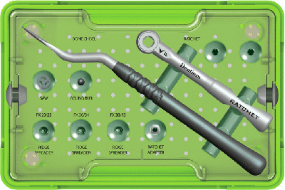 RS Kit (Ridge Spreader Kit) - XRSK